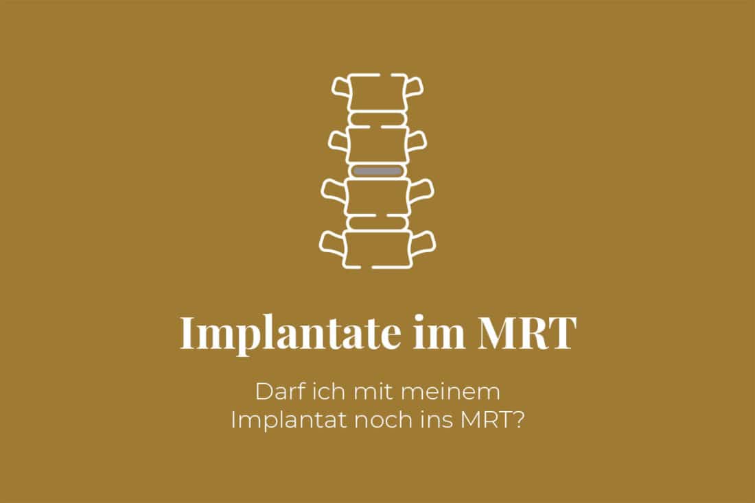 Mit Implantat ins MRT dank ScanWise